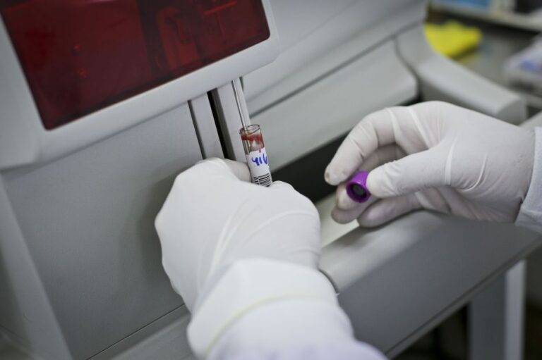 Cientistas avançam no desenvolvimento de diagnóstico de câncer de próstata por exame de sangue | Meio e Saúde Brasil