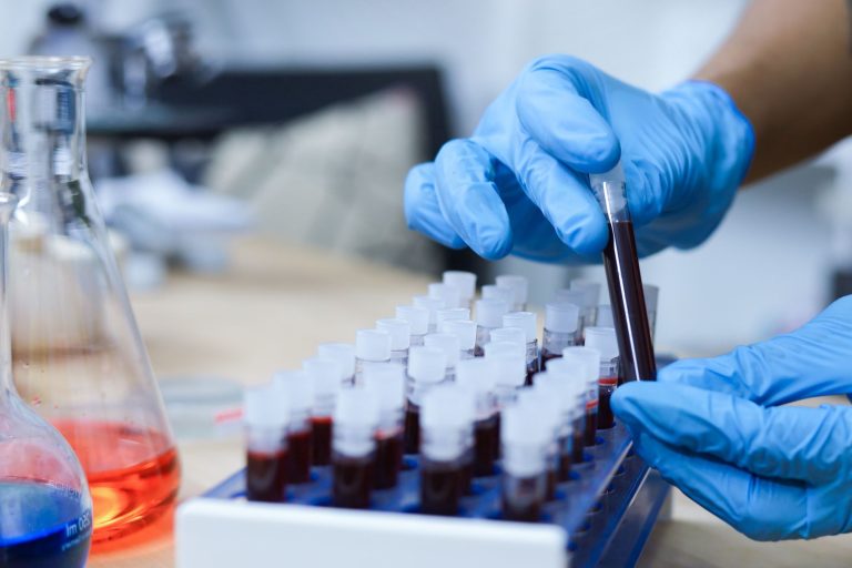 Exame de sangue com IA realiza detecção precoce de nove tipos de câncer | Meio e Saúde Brasil CNN Brasil