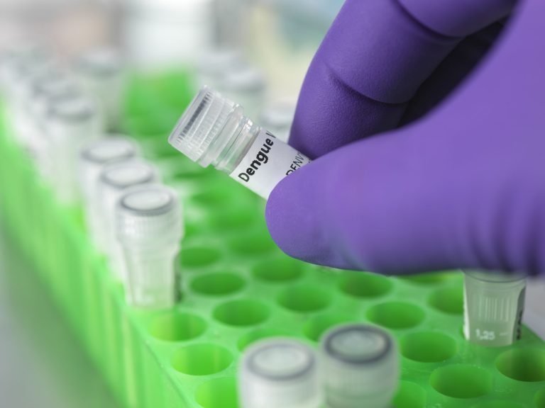 Hospitais em São Paulo enfrentam alta de internações por dengue | Meio e Saúde Brasil CNN Brasil