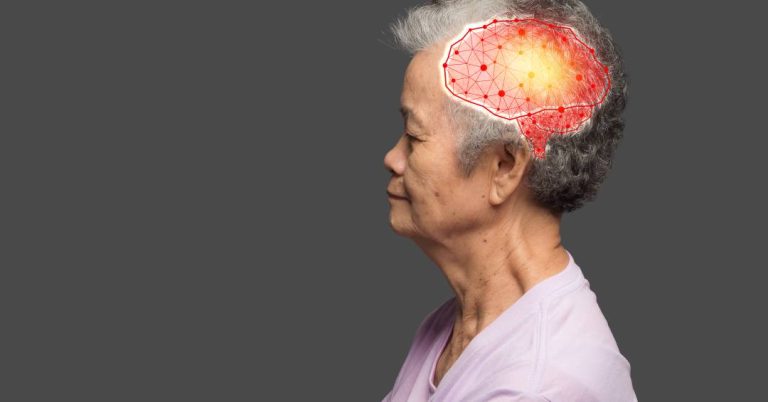 Alzheimer: mulheres são mais afetadas e pesquisa brasileira pode ajudar a entender o porquê